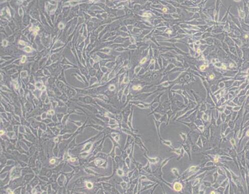 MDA-MB-435S（人乳腺癌细胞/人黑素瘤细胞）,MDA-MB-435S