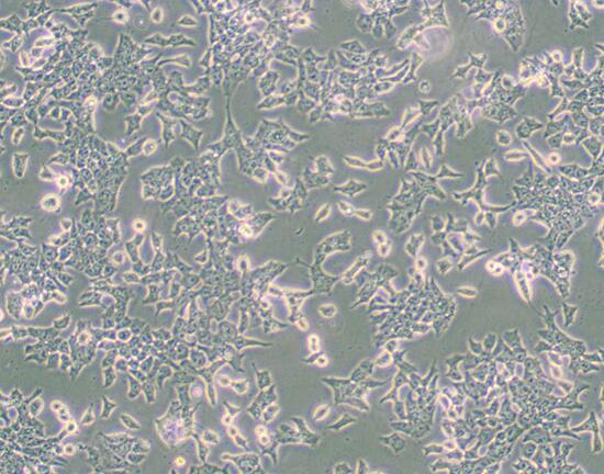 P19 [P-19]（小鼠畸胎瘤细胞）,P19 [P-19]