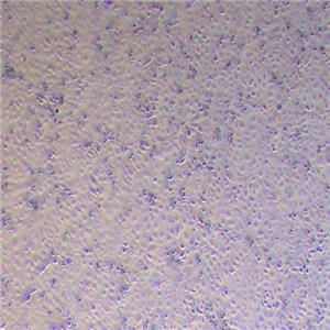 DU145-LUC-PURO（人前列腺癌细胞-荧光素酶标记（STR鉴定正确））