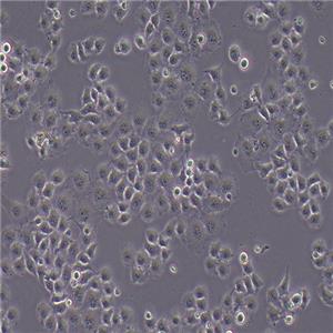 HO-8910PM-LUC（人高转移卵巢癌细胞-荧光素酶标记（STR鉴定正确））