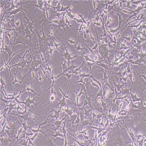 K7M2-WT-GFP（小鼠骨肉瘤成骨細胞-綠色熒光蛋白標記）