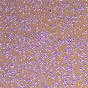 K7M2-WT-GFP（小鼠骨肉瘤成骨細(xì)胞-綠色熒光蛋白標(biāo)記）