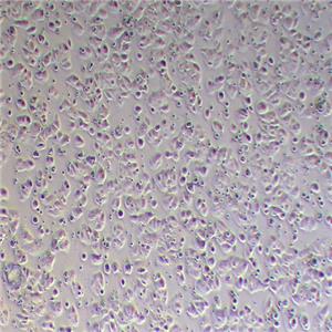 MCF-7-LUC(人乳腺癌细胞-荧光素酶标记（STR鉴定正确）)