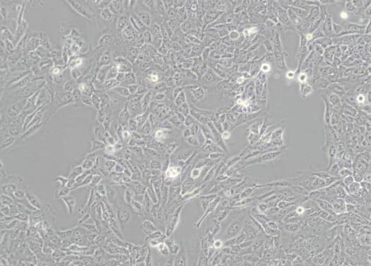 SV-HUC-1（人输尿管上皮永生化细胞）,SV-HUC-1