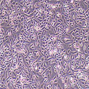 SIHA-LUC(人子宫颈鳞癌细胞-荧光素酶标记（STR鉴定正确）)