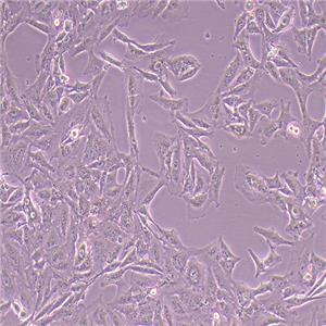 SK-MEL-2-LUC(人皮膚黑色素瘤細(xì)胞-熒光素酶標(biāo)記（STR鑒定正確）)