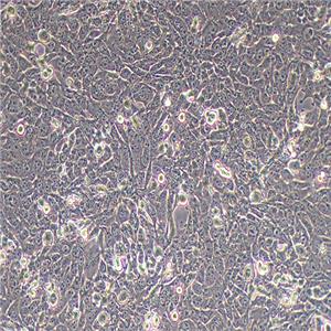 T47D-LUC（人乳腺癌细胞-荧光素酶标记（STR鉴定正确））