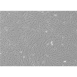 293ET（人胚肾细胞(SV40T和EBNA1基因修饰细胞)）