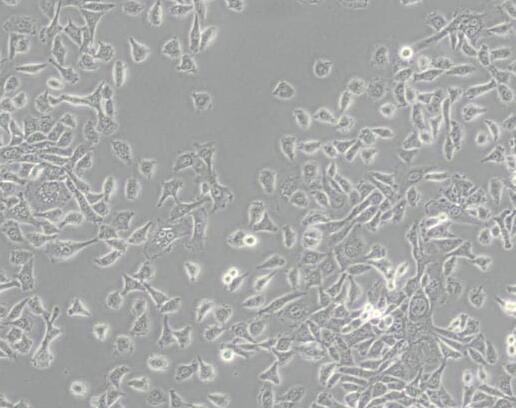 MDA-MB-415 (人乳腺癌细胞)（L15）,MDA-MB-415