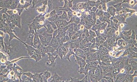 NCI-H1688（人经典小细胞肺癌细胞）,NCI-H1688