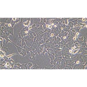 NCI-H1688（人经典小细胞肺癌细胞）