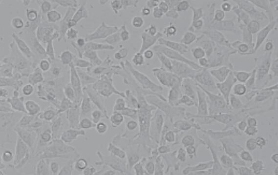 SGC-7901-GFP (人胃腺癌细胞(绿色荧光)),SGC-7901-GFP