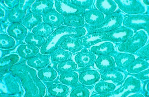 4647（长尾绿猴肾细胞）,Monkey kidney cells