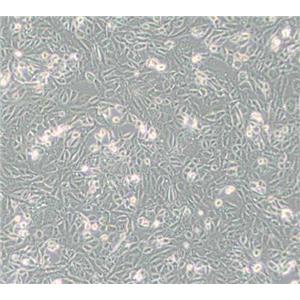 SV40 MES 13（小鼠肾小球系膜细胞）