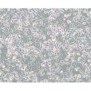 PC-12(低分化)（大鼠肾上腺嗜铬细胞瘤细胞(低分化)）