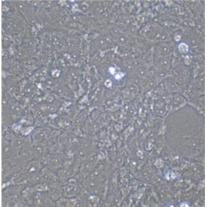 NCI-H441（人肺腺癌细胞）
