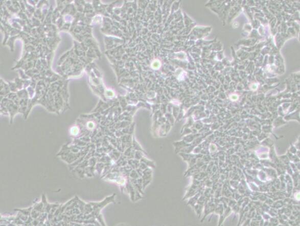 MDA-MB-361 (人乳腺癌细胞) (L15),MDA-MB-361