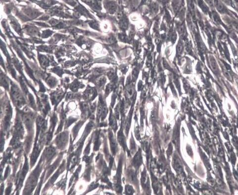 LM9（小鼠HGPRT基因缺陷型骨肉瘤细胞）,LM9