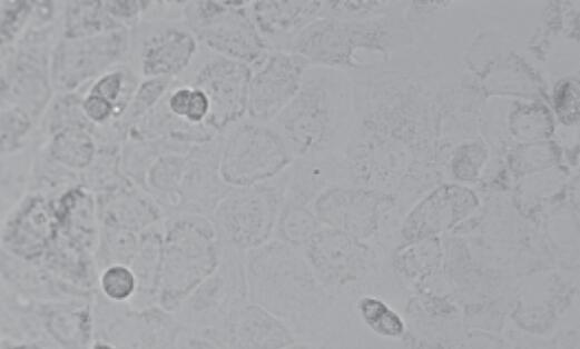 SCC-25 [SCC 25; SCC25]（人舌磷癌细胞）,SCC-25