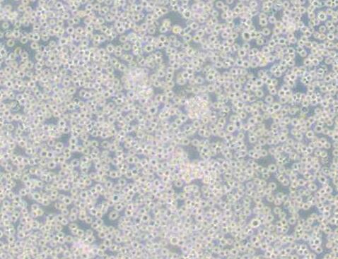 JM(人T淋巴细胞白血病细胞),15P-1