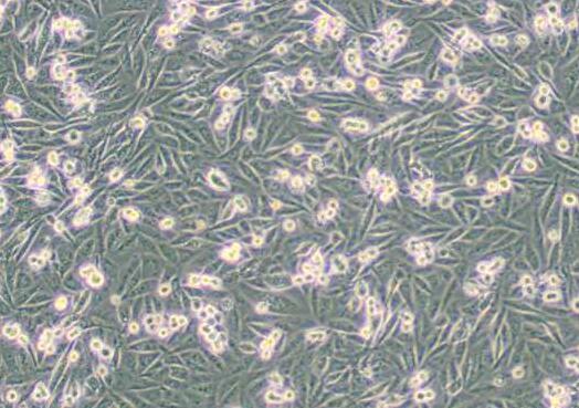 MDA-MB-231/GFP (人乳腺癌细胞(绿色荧光蛋白标记) (L15),MDA-MB-231/GFP