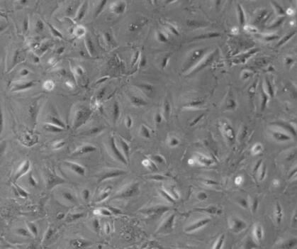 鸡卵泡基膜细胞,Chicken follicle base membrane of cells