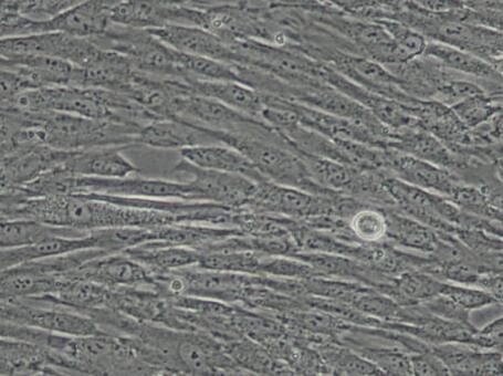 人脐带间充质干细胞,People between umbilical cord mesenchymal stem cells