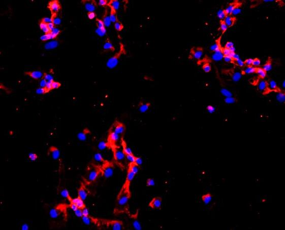 人肺微血管内皮细胞,Human pulmonary microvascular endothelial cells