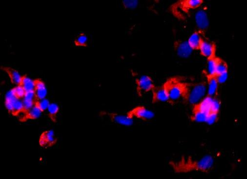 人肺大動脈內(nèi)皮細胞,Pulmonary artery endothelial cells