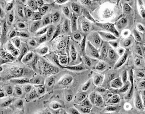 人气管上皮细胞,Human tracheal epithelial cells