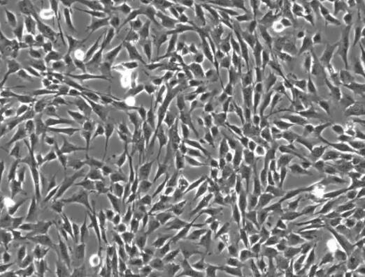 人支气管平滑肌细胞,Human bronchial smooth muscle cells