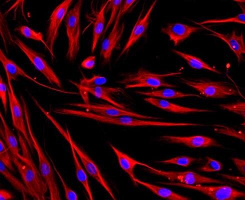 人支气管成纤维细胞,Human bronchial fibroblasts