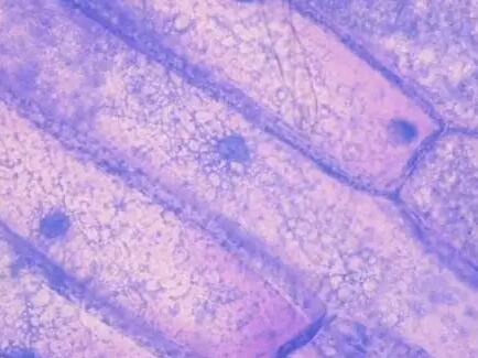 人呼吸道上皮細胞,Human bronchial fibroblasts