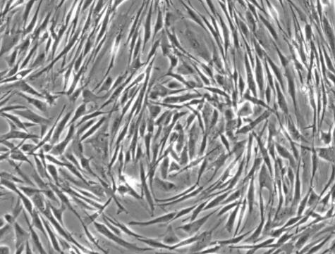 人乳腺成纤维细胞,Human breast fibroblasts