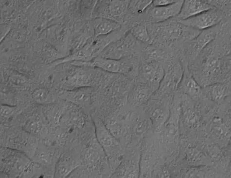 人前列腺上皮细胞,Human prostate epithelial cells