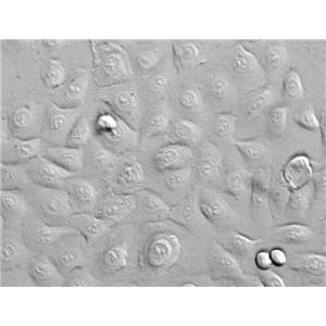 人小气道上皮细胞,Human small airway epithelial cells