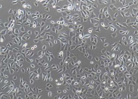 人胰腺上皮细胞,Human pancreatic stellate cells