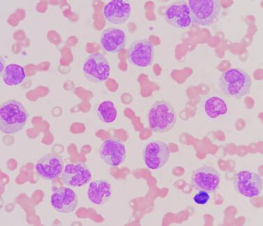 人外周血白细胞,Human peripheral blood leukocytes