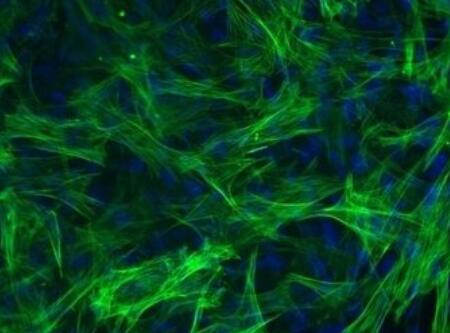 人食管平滑肌细胞,Human esophageal smooth muscle cells