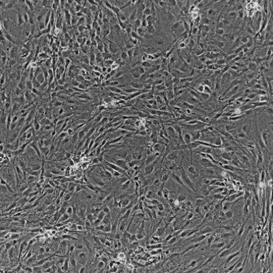 人腸動(dòng)脈內(nèi)皮細(xì)胞,Human intestinal artery endothelial cells