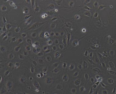 人肠静脉内皮细胞,Human intestinal vein endothelial cells