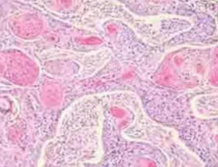 人直腸黏膜上皮細(xì)胞,Epithelial cells of human rectal mucosa