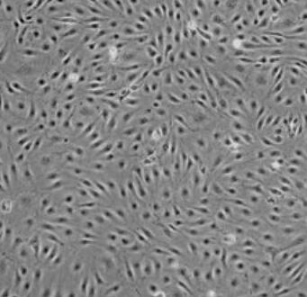 人肝窦内皮细胞,Human sinusoidal endothelial cells