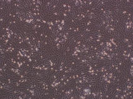 人胎盘绒毛膜滋养层细胞,Human placental chorionic trophoblast cells