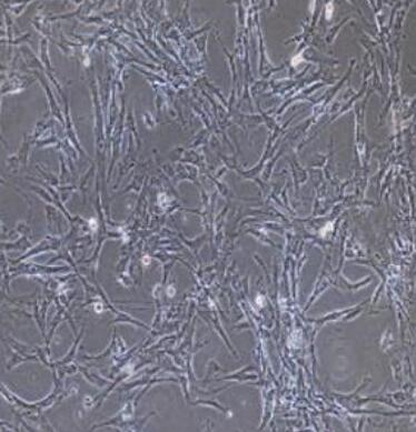 人胎盘绒毛膜细胞,Human placental chorionic cells