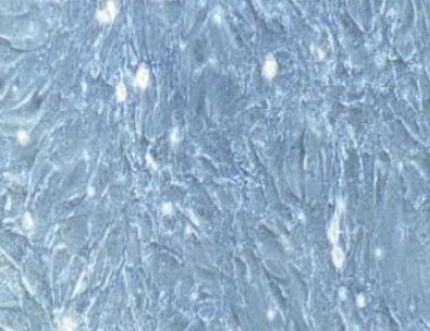 人子宫平滑肌细胞,Human uterine smooth muscle cells