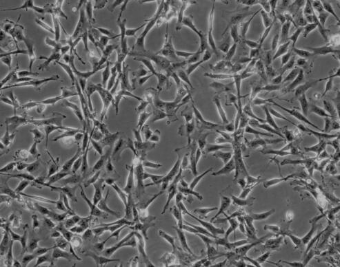 人子宮成纖維細(xì)胞,Human uterine fibroblasts