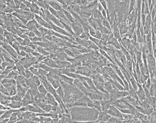 人卵巢成纤维细胞,Human ovarian fibroblasts