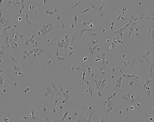 人子宫内膜上皮细胞,Human endometrial epithelial cells