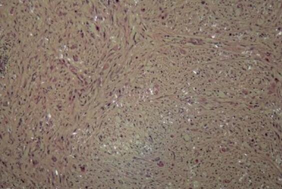 人睾丸支持细胞,Sertoli cells of human testis